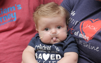 Historic heart-lung transplant brought hope to Baby Jack and his family