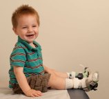 Pediatric leg brace