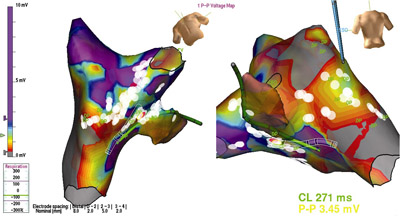 3D heart mapping