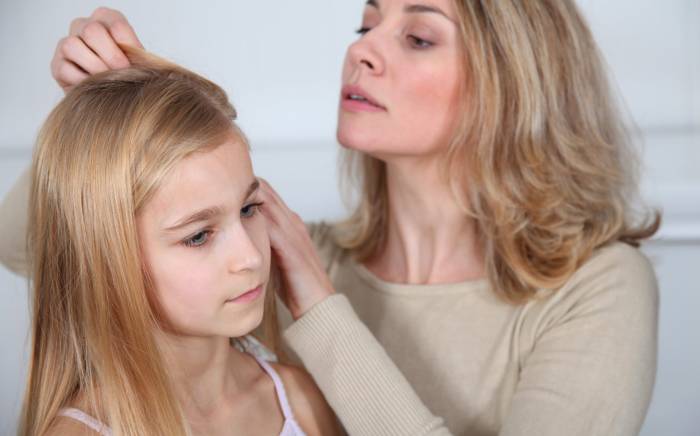 Back-to-School: Head Lice Prevention and Treatment