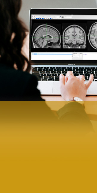 Doctors reviewing brain scans