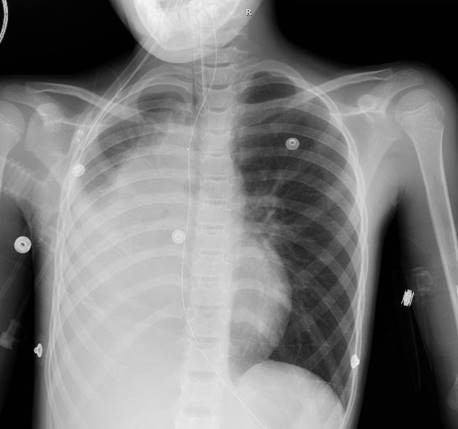 Case Study: Granular