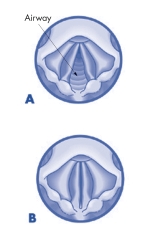 Airway Figures A and B