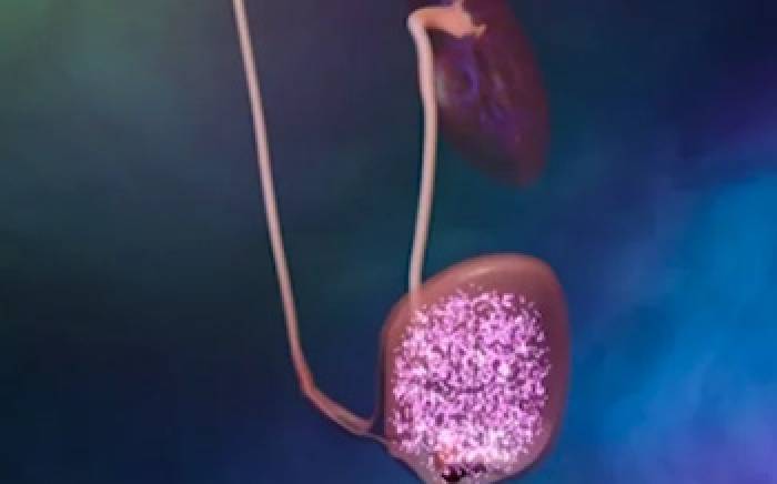 Urinary Tract Infection