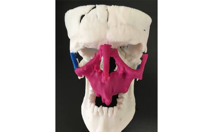 3D Skull, angle 1