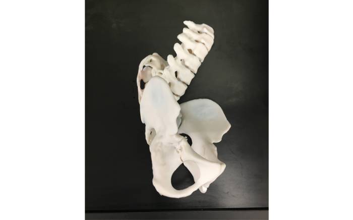 3D Spine, angle 1