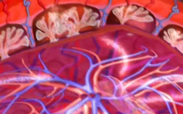 Medical Animation: Down Syndrome