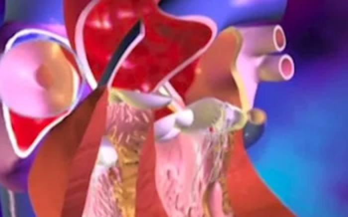 Medical Animation: Prenatal Heart Circulation