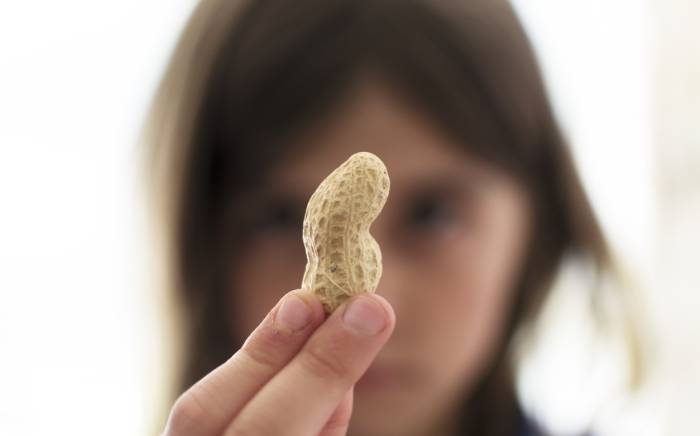 Some food for thought on food allergies