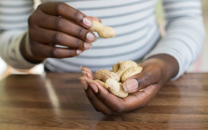 Should I consider oral immunotherapy for my child with a peanut allergy?