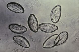 Pinworm Eggs Under a Microscope