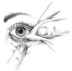 First Aid - Foreign Object Under Lower Eyelid