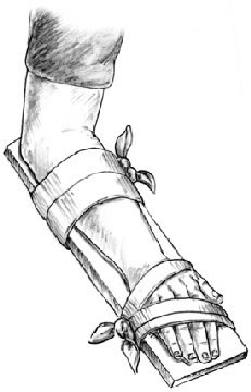 First Aid - Splint for Wrist Injury